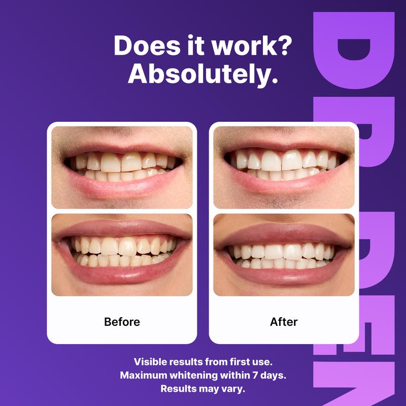 Purple Teeth Whitening Strips