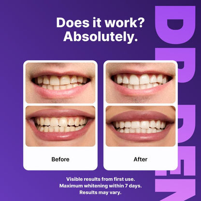 Purple Teeth Whitening Strips